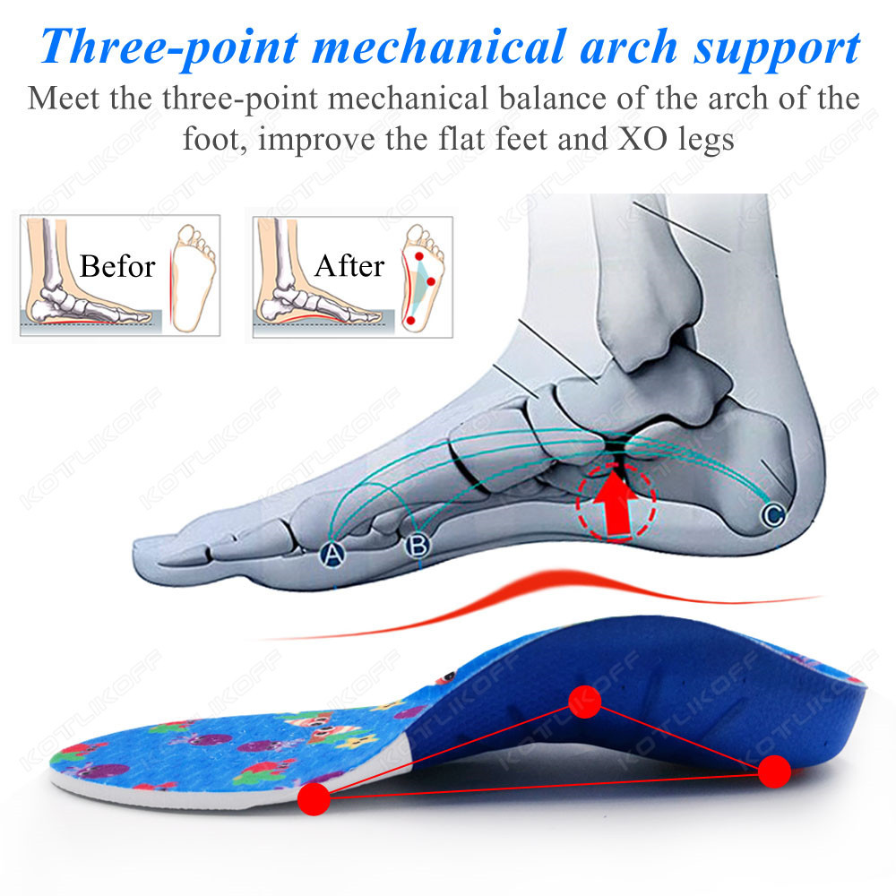 子供整形外科インソール偏平足高アーチサポート補正 OX 脚外 - Women'S Shoes High Arch Support のレビューと価格