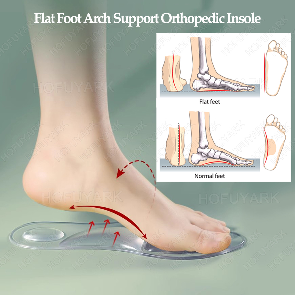 シリコーンゲルインソール整形外科扁平足アーチサポート足底筋膜 - Women'S Shoes High Arch Support のレビューと価格